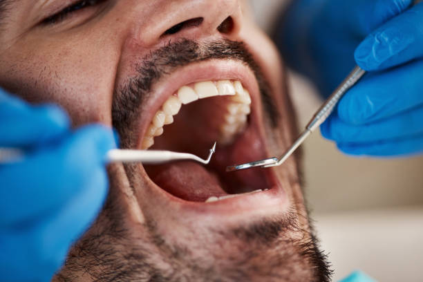 Best Mobile Emergency Dentist in Albany, IN