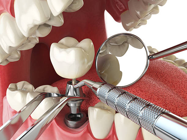Best Emergency Dental Services for Seniors in Albany, IN